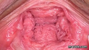 Speculum