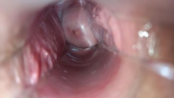 A Speculum...